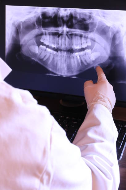 Best Chipped Tooth Repair Near Me  in Iraan, TX