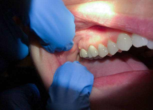 Best Emergency Gum Pain Relief  in Iraan, TX